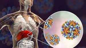 
	پاورپوینت هپاتیت
