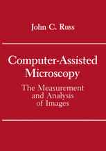 Computer-Assisted Microscopy: The Measurement and Analysis of Images