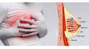 
	پاورپوینت مشکلات پستان
