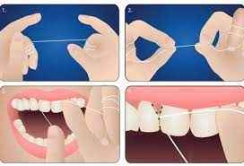 
	پاورپوینت بهداشت دهان و دندان در افراد هموفیل و بیماران با اختلالات خونریزی دهنده ی ارثی
