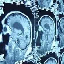 
	پاورپوینت مدیریت کیفی در مراکز پرتو تشخیصی
