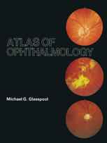 Atlas of Ophthalmology