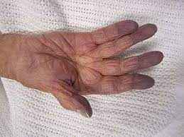 
	پاورپوینت هیپوکسی مهمترین و شایع ترین علل
