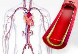 
	پاورپوینت هيپرتانسيون یا فشارخون
