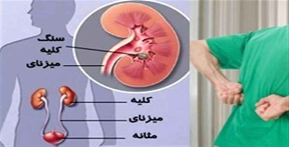 
	پاورپوینت بیماریهای کلیه و مجاری ادرار
