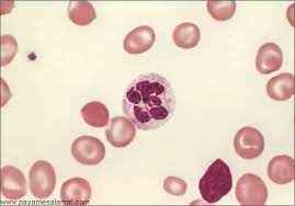 
	پاورپوینت آنمی مگالوبلاستیک
