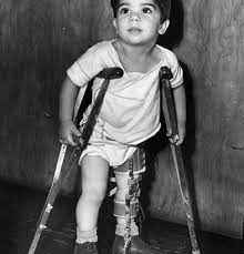 
	تحقیق فلج اطفال
