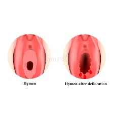 
	پاورپوینت Hymen پرده بكارت
