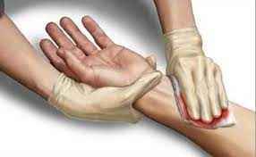 
	پاورپوینت خونریزی ها
