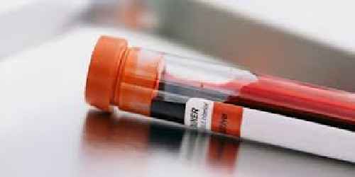 
	پاورپوینت نحوه صحیح ارسال نمونه های پاتولوژی
