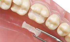 
	تحقیق دندانپزشكي ترميمي
