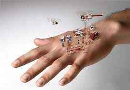 
	پاورپوینت زخم ها
