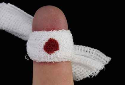 
	پاورپوینت روشهای کنترل خونریزی
