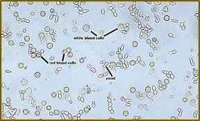 
	پاورپوینت آزمایش رسوب ادرار
