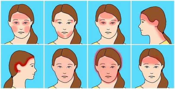 
	پاورپوینت سردرد ها و چگونگی رفع آنها
