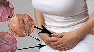 
	پاورپوینت علل عفونت
