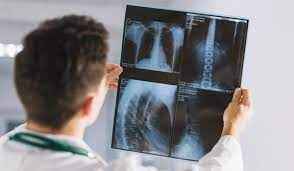 
	تحقیق راديوگرافي
