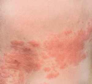 
	پاورپوینت زونا
