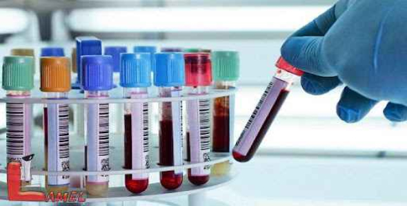 
	پاورپوینت انواع آزمایشات
