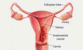 
	پاورپوینت اختلالات عملکردی رحم
