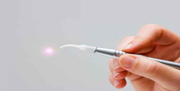 لیزر در دندان پزشکی