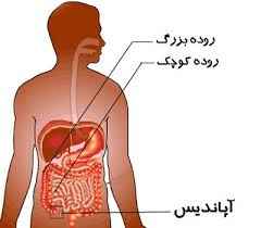 
	پاورپوینت بررسی آپاندیس
