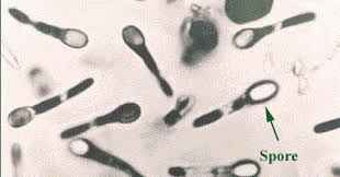 
	گزارش کار آزمایشگاه با عنوان تشخیص اسپور
