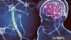 
	تحقیق بيماري ام اس يا اسكلروز چندگانه MS
