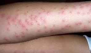 
	پاورپوینت نقش و وظایف بهداشت محیط در پیشگیری از بروسلوز (بیماری تب مالت)
