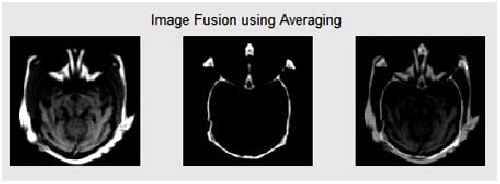 ادغام تصاویر
