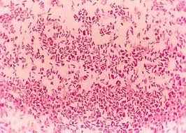 
	تحقیق باکتری
