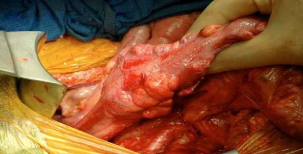     پاورپوینت بررسی سرطان روده بزرگ در 9اسلاید زیبا و قابل ویرایش با فرمت pptx - فروشگاه فایل
