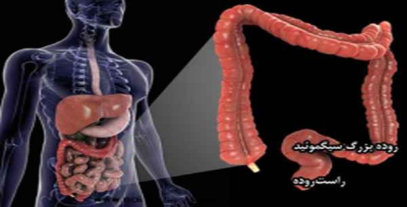     پاورپوینت بررسی سرطان کولو رکتال - فروشگاه فایل
