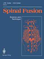 Spinal Fusion: Science and Technique