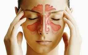 
	پاورپوینت سينوزيت
