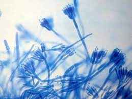 
	پاورپوینت آسکوکارپ
