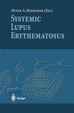 Systemic Lupus Erythematosus
