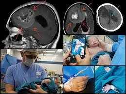 
	تحقیق جراح مغز و اعصاب و شناخت حیطه ی وظایف آن
