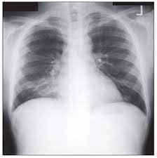 
	پاورپوینت جزوه تحلیل تفسیر تصاویر رادیوگرافی
