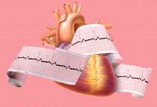 
	پاورپوینت الكتروكارديوگرافي
