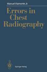 Errors in Chest Radiography