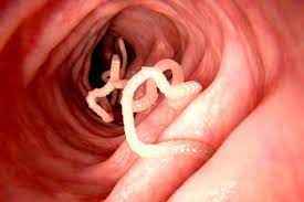 
	پاورپوینت کرمهای قلابدار انسانی
