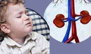 
	تحقیق ارزش تشخيصي سونوگرافي در تعيين اسكار كليوي در كودكان
