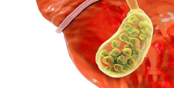 
	پاورپوینت بررسی كيسه صفرا
