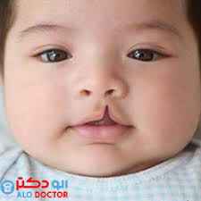 
	تحقیق ناهنجاری های مادرزادی
