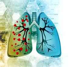 
	پاورپوینت مبارزه با سل
