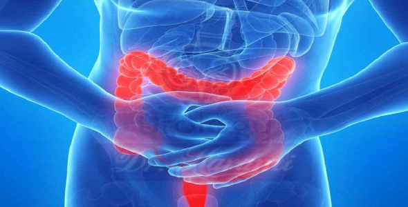 
	پاورپوینت آپاندیسیت
