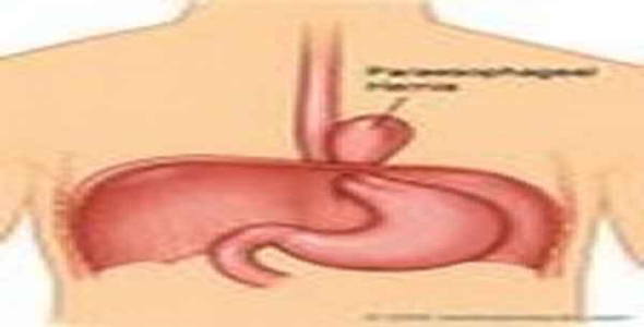     پاورپوینت اختلالات مری - فروشگاه فایل
