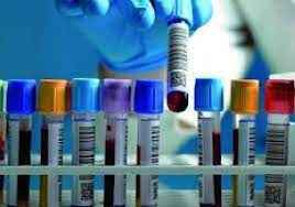 
	پاورپوینت نمونه گیری و تفسیر ABG و CBC
