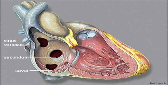     پاورپوینت نقص دیواره بین دهلیزی ASD - فروشگاه فایل
